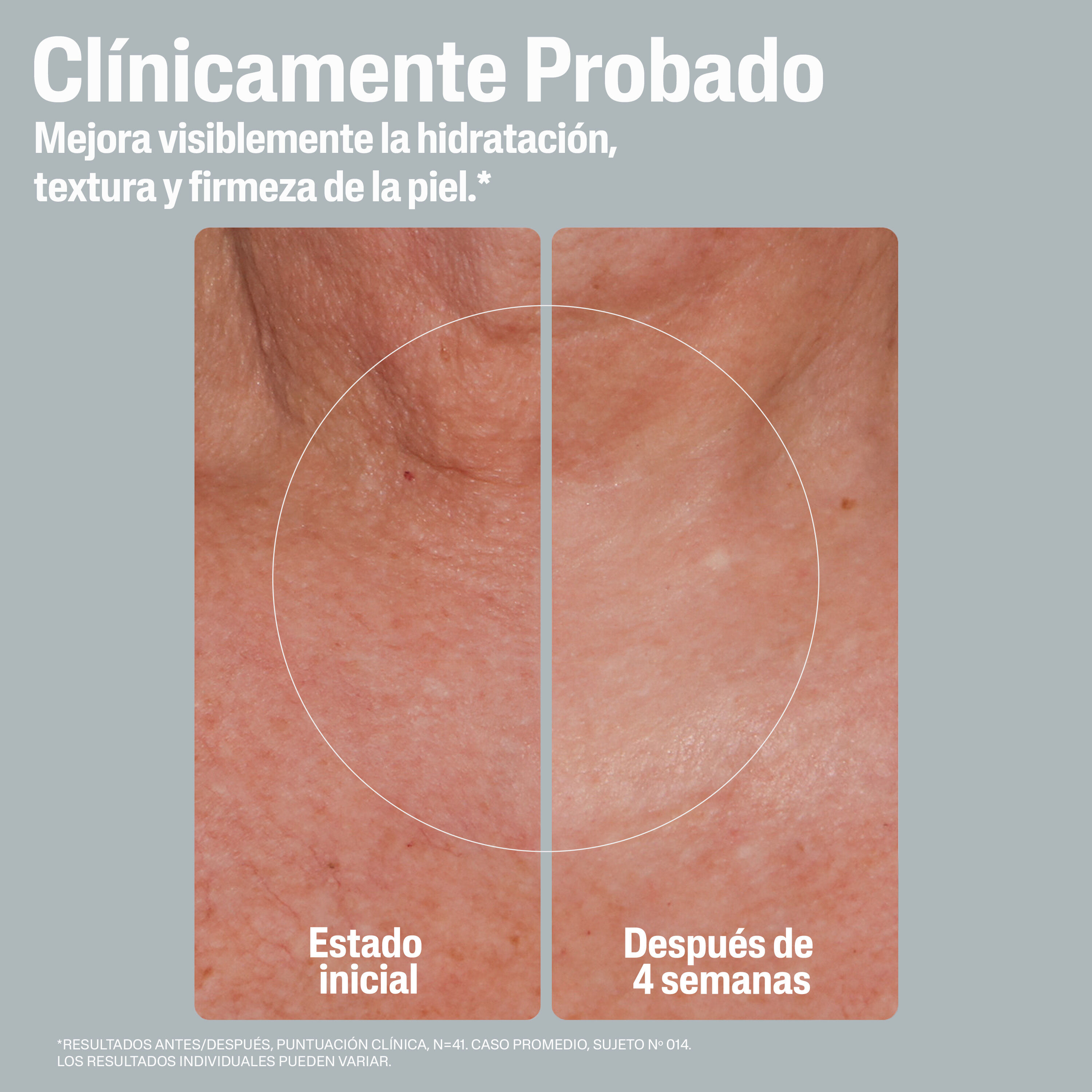 Skin Activator Crema Reafirmante para la Longevidad de la Piel